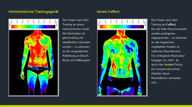 Itensic Zirkel - 3er Set medizinische Kraftgeräte - Effect Trio, Hersteller Proxomed, Medizinzulassung MPG, gebraucht - überholter Zustand